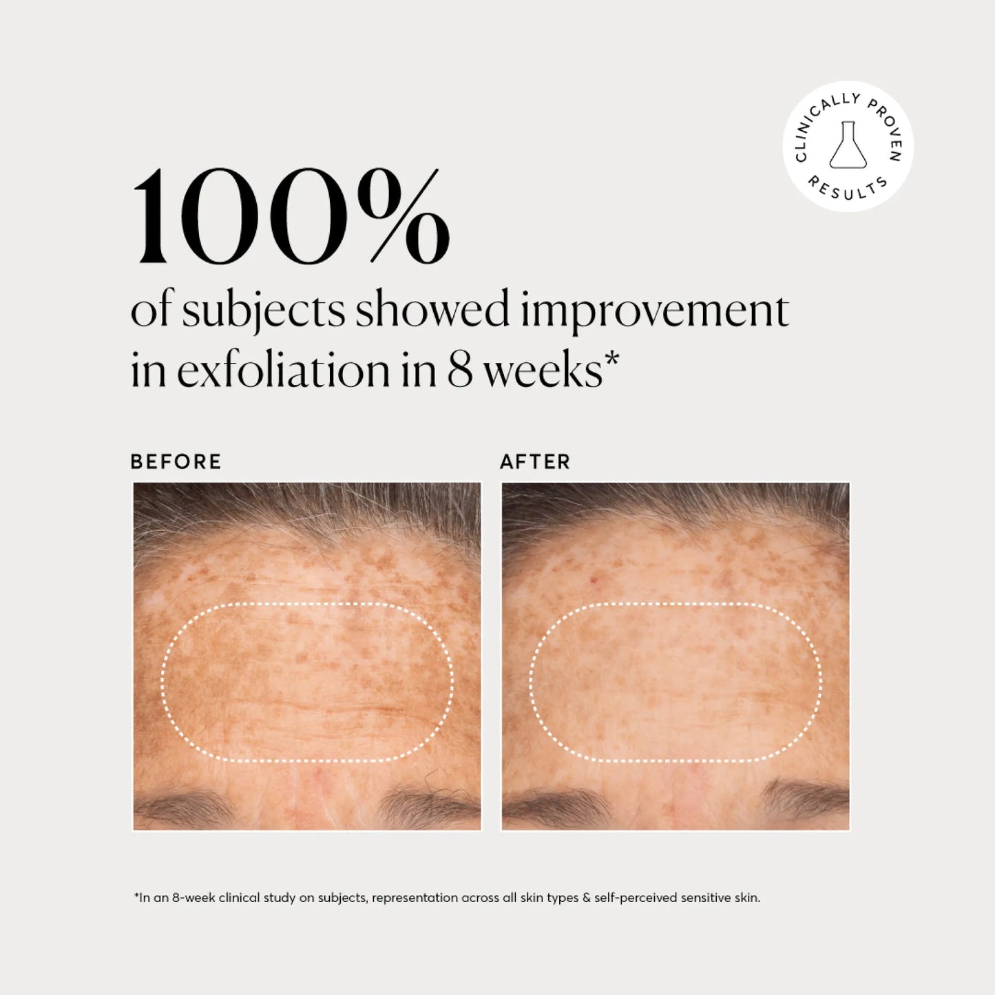bha-liquid-exfoliant-2-n0 NATR-10027-Alt-Images-BHA-Liquid-Exfoliant-2_-03.webp